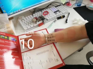 三菊抗敏剂，15分钟退敏退红
